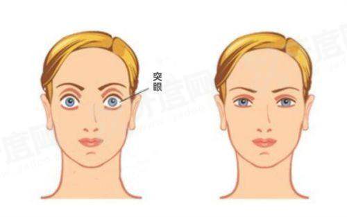 长沙旺旺医院眼科价格表：半飞秒9.3k/全飞秒1.38w元起