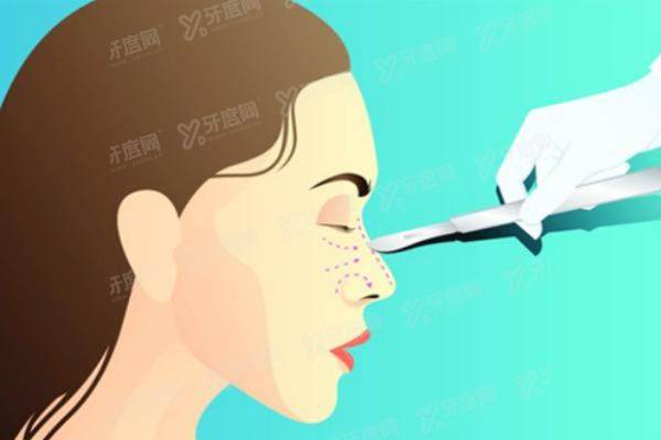 广州曙光医院蒋思<span style=