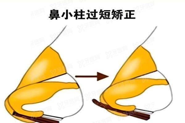 郑州胡志成在河南哪个整容医院