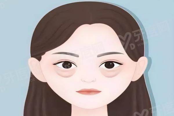 广州健丽祛眼袋三位院长哪个好 广州健丽祛眼袋三位院长哪个好