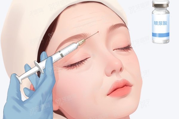 深圳南雅医院做额头缩小术多少钱 深圳南雅医院做额头缩小术多少钱