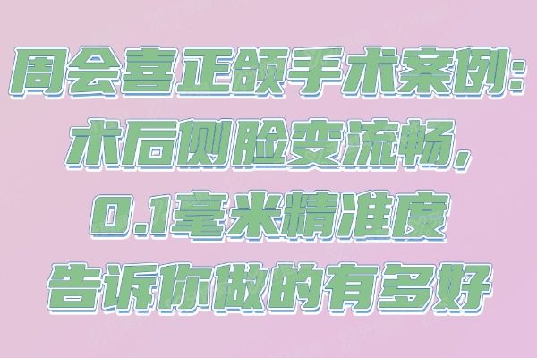 周会喜正颌手术案例:术后侧脸变流畅,0.1毫米精准度告诉你做的有多好