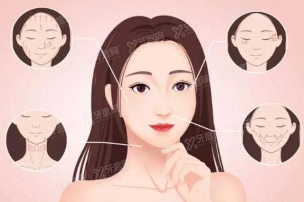 李晓东面部提升手术水平怎么样.jpg 李晓东面部提升手术水平怎么样.jpg
