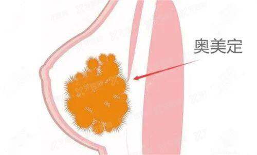 梅够明做鼻子怎么样?鼻修复技术优势+收费价格+坐诊地址+患者案例揭晓