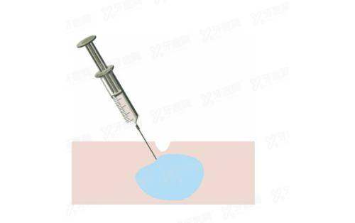 吕瑛医生口碑实例