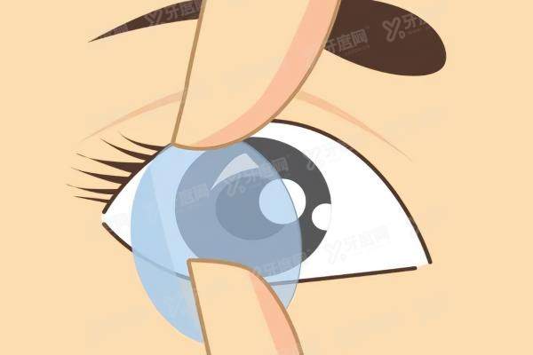 阿尔法角膜塑形镜上有编号吗?表面有专属编码!带你了解辨别真伪方法及颜色区分