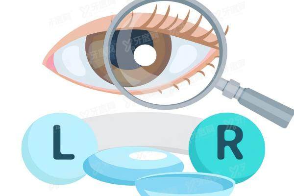 阿尔法角膜塑形镜怎么辨别真伪.jpg 阿尔法角膜塑形镜怎么辨别真伪.jpg