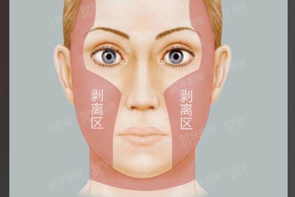 辽宁曙光整形外科医院怎么样?技术靠谱体验好!速览收费标准与医院地址