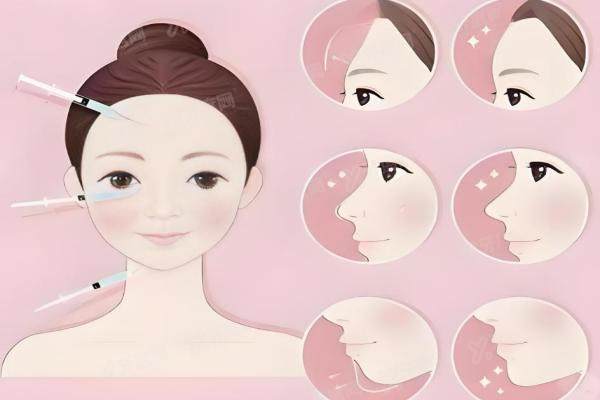 上海艺星郭敬松院长怎么预约？可线上咨 询！他面部填充效 果超棒,案 例超惊艳！2