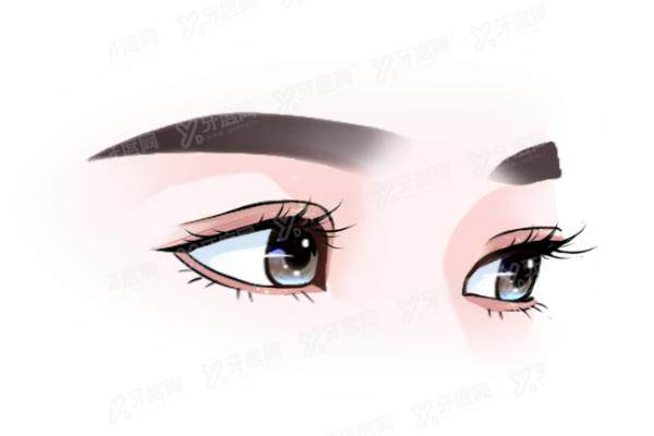 厦门双眼皮修复手术哪里做比较好?公布厦门双眼皮修复医院排名前十