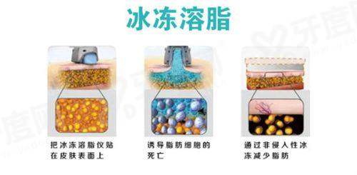 四、李献和医生磨骨怎么样?的预约挂号方式