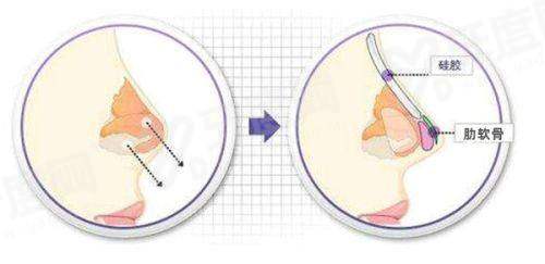 朱慧东馒化修复多少钱？
