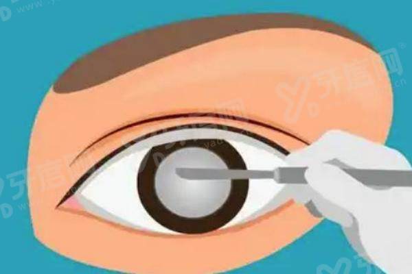 胡敏医生的读写镜.jpg 胡敏医生的读写镜.jpg