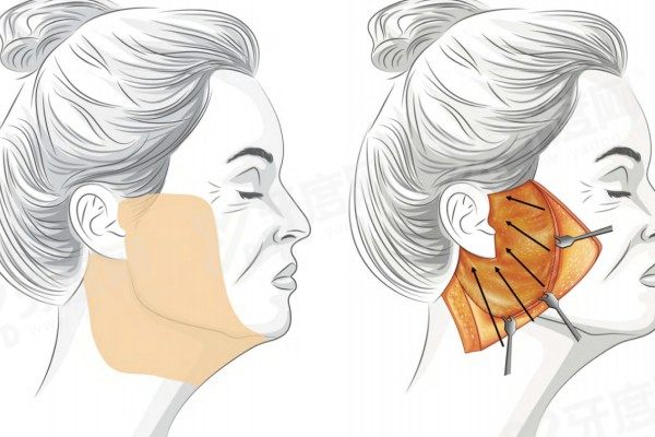 李献和医生怎么预约 李献和医生怎么预约