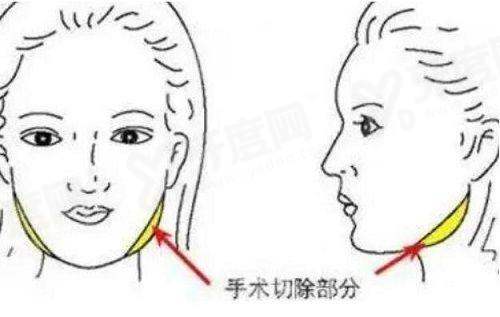 取面部异物的正规医院排名前十名有哪些? 取面部异物的正规医院排名前十名有哪些?