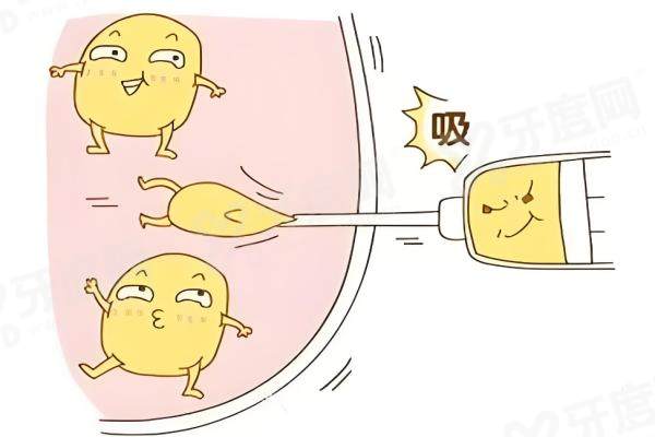 1761895747283778.jpg 吸脂.jpg