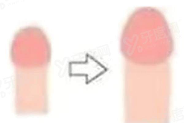 杭州阿波罗医院口碑怎么样 杭州阿波罗医院口碑怎么样