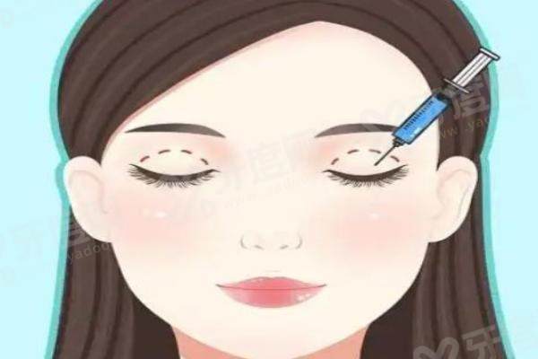 武汉谭琳医生的口碑和评价咋样?患者评价都说双眼皮案例技术好,口碑赞!