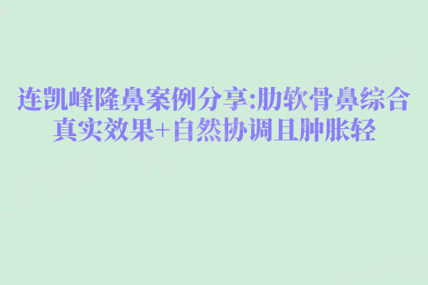连凯峰隆鼻案例分享:肋软骨鼻综合真实效果+自然协调且肿胀轻