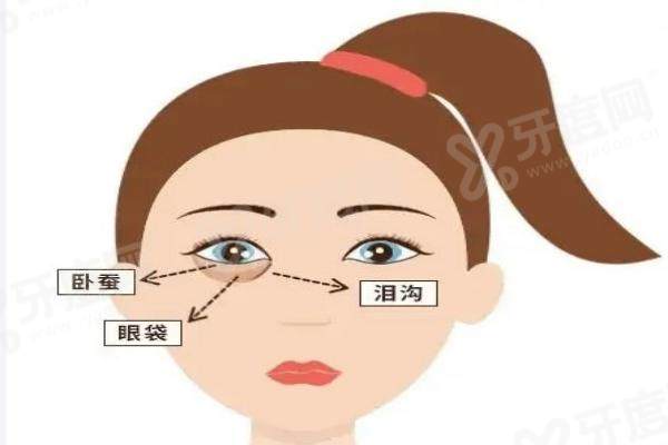 北京填充泪沟哪家比较好