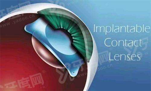 淮安光明眼科医院地址在哪?