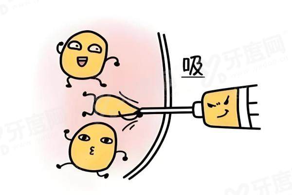 万晓楠做人鱼体雕价格表：单部位1.5W+/腰腹环吸1.98W+/多部位联合4W+3