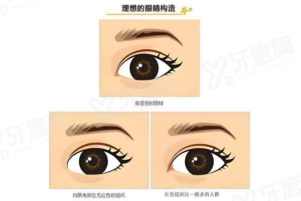 郑小红双眼皮修复价目表：双眼皮修复1.28W+/眼窝凹陷填充修复6.8k+3