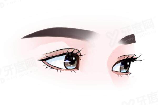 余东眼睛修复很贵吗技术怎么样？2025年闭眼无痕修复全解析