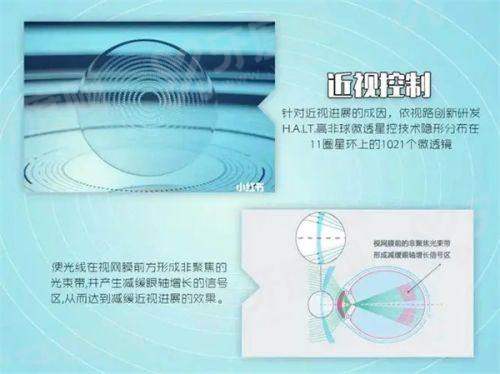 保定新视眼科医院白内障手术怎么样?专家经验丰富/费用合理/效果超赞！