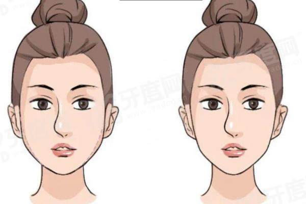 吴贞跃修复馒化脸怎么收费