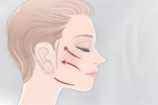 王圣雷医生做拉皮手术技术好吗 王圣雷医生做拉皮手术技术好吗