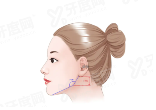 齐越医生后巩膜加固手术效果如何？在全国的口碑都不错，揭秘坐诊一览表！
