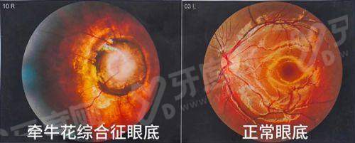 二、邯郸爱尔眼科医院怎么样