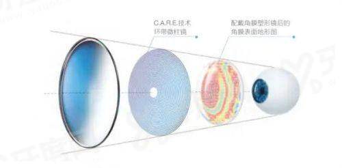 三、西安百视佳眼科医院地址在哪里？