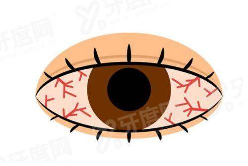 小结：北京同仁眼科王宁利怎么挂号？3个核心优势让看诊更安心