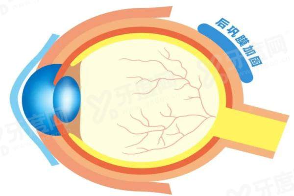 封康和王乐今谁更厉害？后巩膜加固术各有特色，长久有效口碑佳！