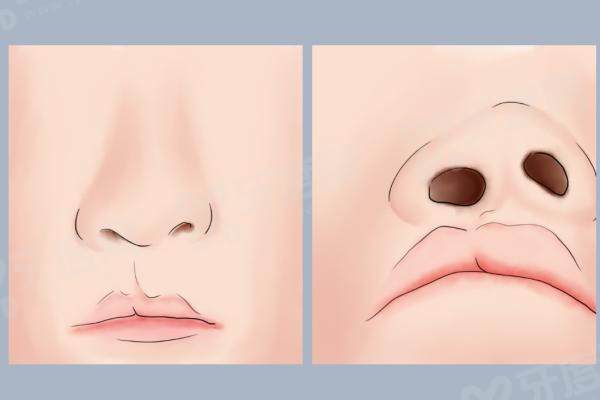 1762508957537904.jpg 唇腭裂修复.jpg