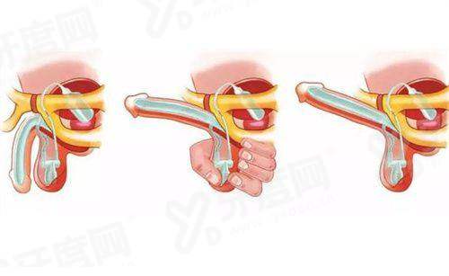 二、西安四院眼科怎么样?