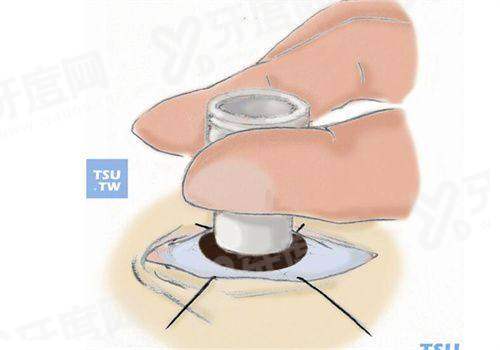 齐越医生在全国的口碑广受好评：探寻乔利亚医生擅长领域与出诊时间