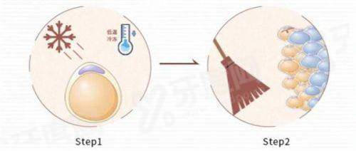 湛江爱尔奥理德眼科医院怎么样？医院简介+价格表+地址电话公布！
