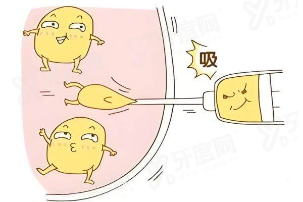 北京纯脂医院是正规品牌吗？是正规机构，冯斌院长团队预约提前免等待更省心！