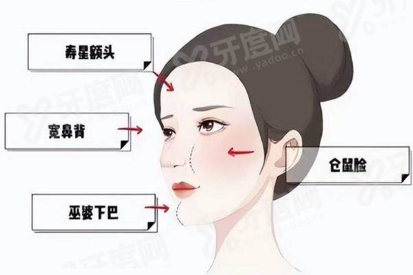 张立彬馒化脸修复费用：面吸馒化修复6980元起/生长因子馒化修复15800元起，那张立彬馒化脸修复超90%的修复满意度