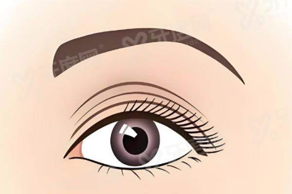 北京吴焱秋医生做双眼皮修复多少钱 ？单侧高难度双眼皮修复2万起|双侧复杂双眼皮修复3万起