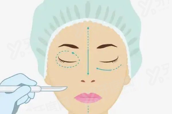 上海瑞东医院眼科怎么样？正规靠谱，医院评价+眼科专家实力公布！