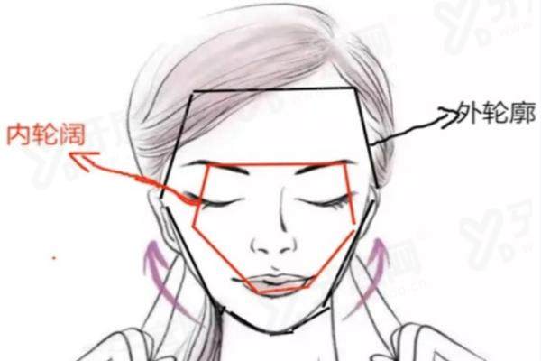 北京三仁医美做轮廓固定多少钱？轮廓固定2.9W+技术好口碑佳
