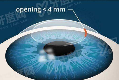 北京同仁眼科医院离哪个火车站近?离北京站更近一些，附地址+价格表+挂号攻略！