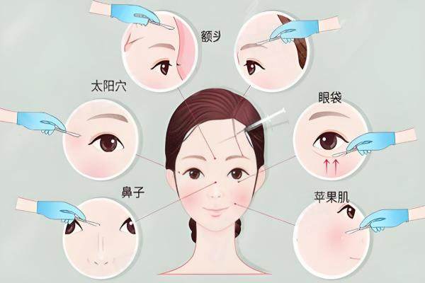 丁小邦取生长因子价格6000元起，不同部位价格有别，那丁小邦取生长因子到底怎么样？众多案例给答案！