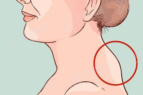 微创治疗富贵包多少钱？受手术方式等因素影响10000-20000元不等，2025微创治疗富贵包哪个医院做的好有答案啦！