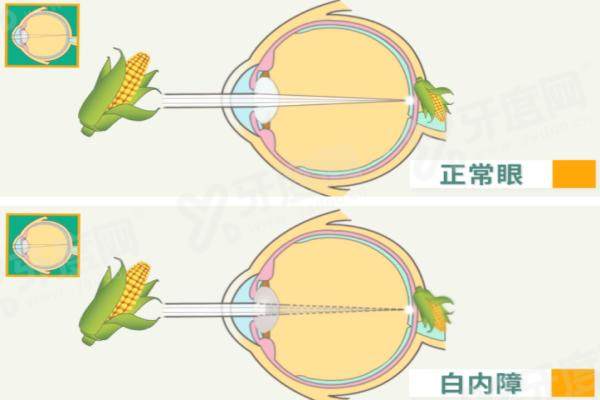 新疆排名前一的眼科医院是哪家？乌鲁木齐普瑞眼科！近视手术好医生汇总，术后裸眼视力 1.0+！