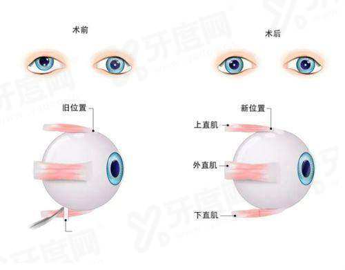 齐齐哈尔北满鸿鹏眼科医生介绍：含张振军/陈岑/于洋医生简介+价格表+地址电话